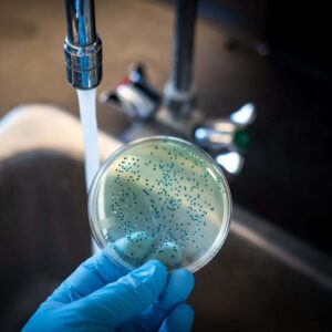 Bacteria Test